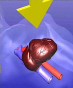 Воздействие на сердце при стернальной компресии