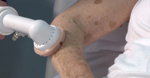 Мытье  насадкой для душа на автоматический памперс для лежачих больных